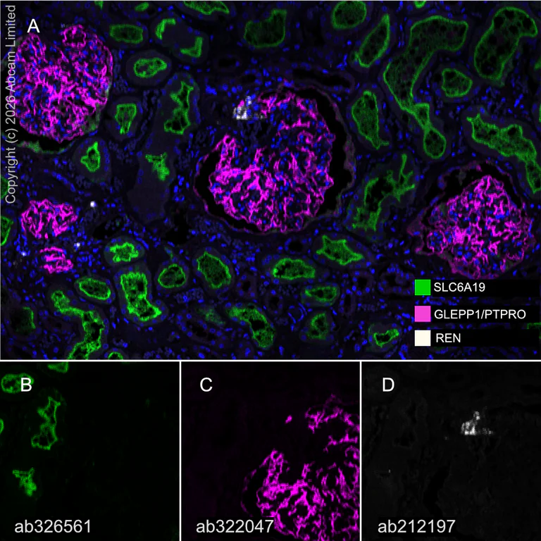 Multiplex immunohistochemistry - Anti-GLEPP1/PTPRO antibody [EPR28645-553] (AB322047)