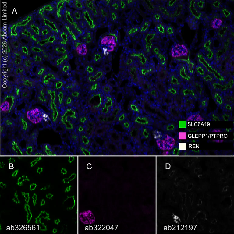 Multiplex immunohistochemistry - Anti-GLEPP1/PTPRO antibody [EPR28645-553] (AB322047)
