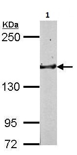 Western blot - Anti-GLG1 antibody (AB262704)
