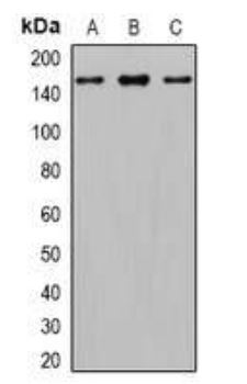 Western blot - Anti-Gli1 antibody (AB273018), expandable thumbnail