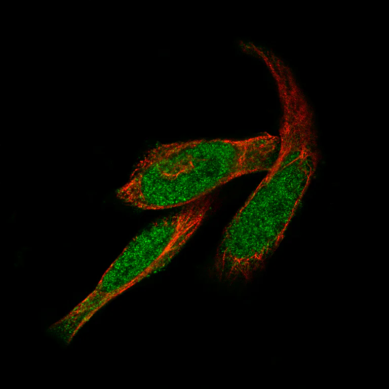 Immunocytochemistry/ Immunofluorescence - Anti-GLI1 Antibody [CL12193] (AB327139)