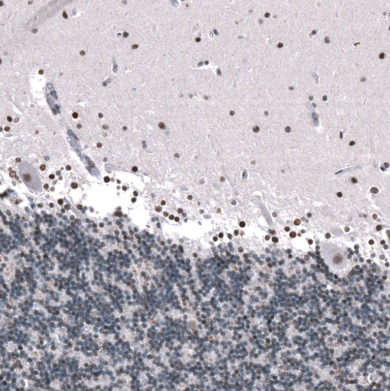 Immunohistochemistry (Formalin/PFA-fixed paraffin-embedded sections) - Anti-GLI1 Antibody [CL12193] (AB327139)