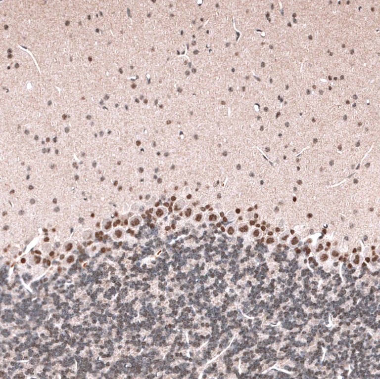 Immunohistochemistry (Formalin/PFA-fixed paraffin-embedded sections) - Anti-GLI1 Antibody [CL12193] (AB327139)