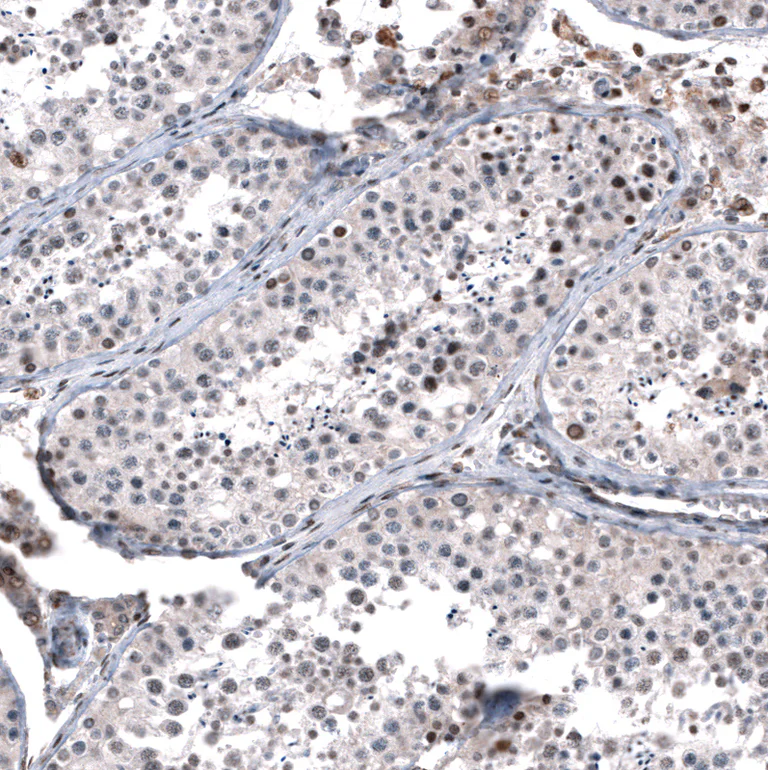 Immunohistochemistry (Formalin/PFA-fixed paraffin-embedded sections) - Anti-GLI1 Antibody [CL12193] (AB327139)