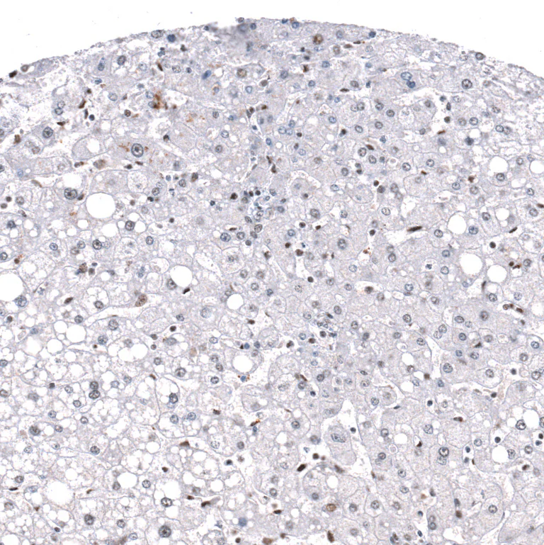 Immunohistochemistry (Formalin/PFA-fixed paraffin-embedded sections) - Anti-GLI1 Antibody [CL12193] (AB327139)