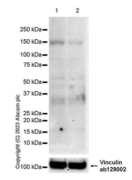 Western blot - Anti-Gli1 antibody [EPR4523] (AB134906), expandable thumbnail