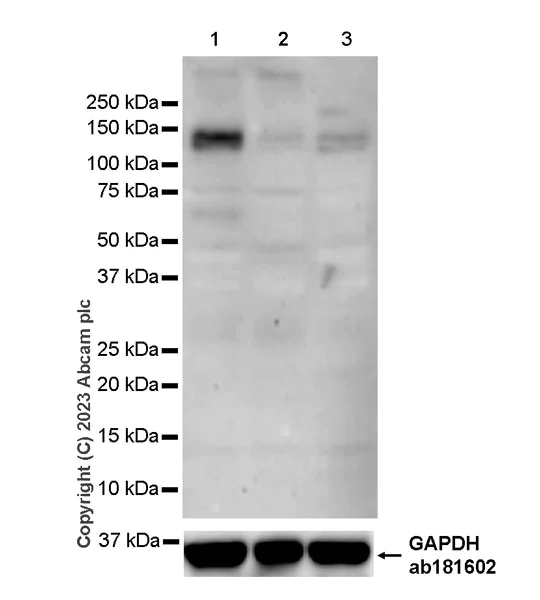 Western blot - Anti-Gli1 antibody [EPR4523] - BSA and Azide free (AB240088)