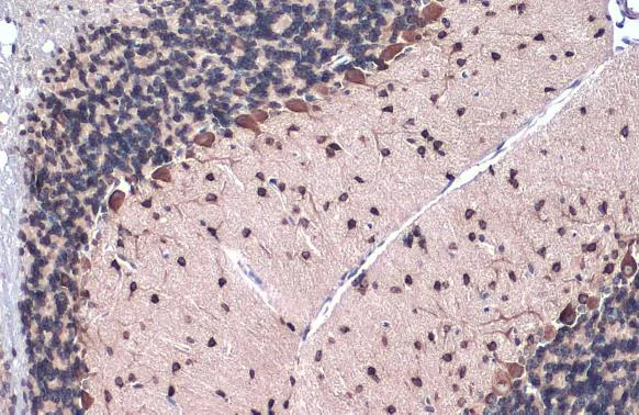 Immunohistochemistry (Formalin/PFA-fixed paraffin-embedded sections) - Anti-Gli1 antibody [HL247] - BSA and Azide free (AB289368)