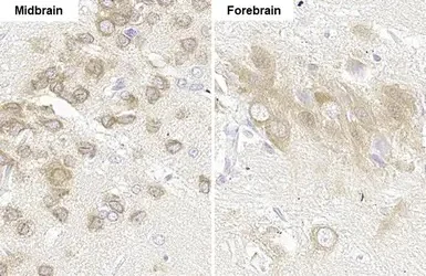 Immunohistochemistry (Formalin/PFA-fixed paraffin-embedded sections) - Anti-Gli1 antibody [HL247] - BSA and Azide free (AB289368)