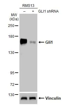 Western blot - Anti-Gli1 antibody [HL247] - BSA and Azide free (AB289368)