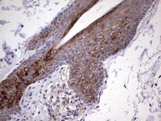 Immunohistochemistry (Formalin/PFA-fixed paraffin-embedded sections) - Anti-Gli2 antibody [OTI1F9] (AB187386), expandable thumbnail