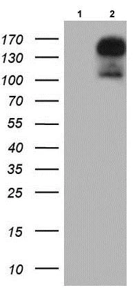 Western blot - Anti-Gli2 antibody [OTI1F9] (AB187386)