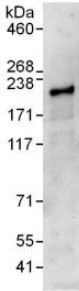 Immunoprecipitation - Anti-Gli3 antibody (AB123495)