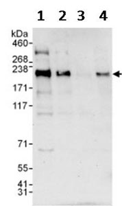 Western blot - Anti-Gli3 antibody (AB123495)
