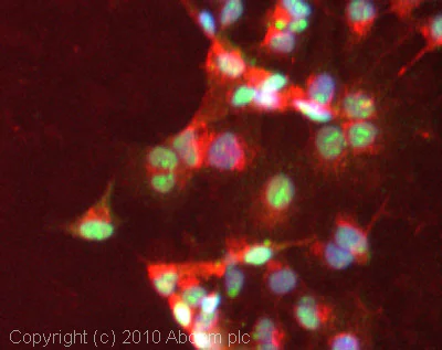 Immunocytochemistry/ Immunofluorescence - Anti-Gli3 antibody (AB6050)