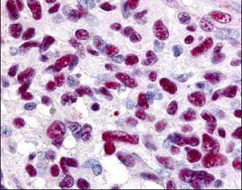 Immunohistochemistry (Formalin/PFA-fixed paraffin-embedded sections) - Anti-Gli3 antibody (AB6050)