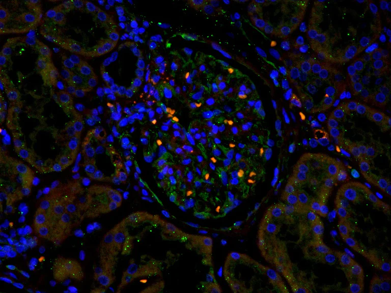 Immunocytochemistry/ Immunofluorescence - Anti-Gli3 antibody [EPR4594] (AB181130)