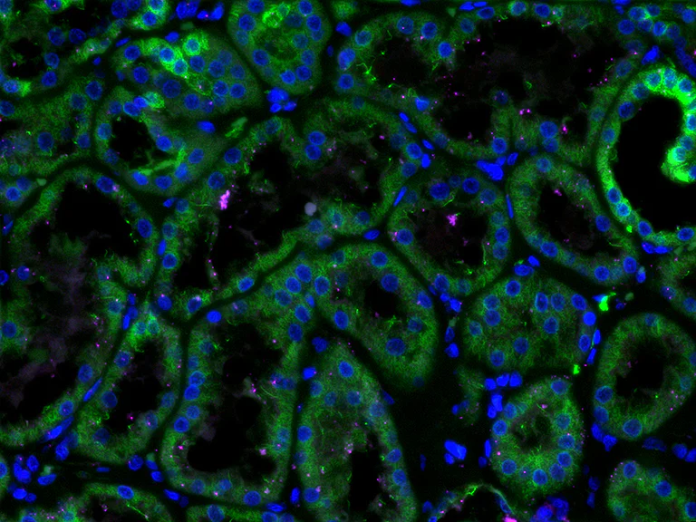 Immunohistochemistry (Formalin/PFA-fixed paraffin-embedded sections) - Anti-Gli3 antibody [EPR4594] (AB181130)