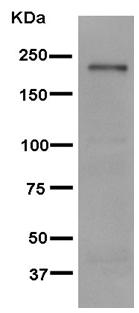 Western blot - Anti-Gli3 antibody [EPR4594] (AB181130), expandable thumbnail