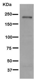 Western blot - Anti-Gli3 antibody [EPR4594] (AB181130)