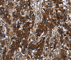 Immunohistochemistry (Formalin/PFA-fixed paraffin-embedded sections) - Anti-GLIPR1 antibody (AB198215)