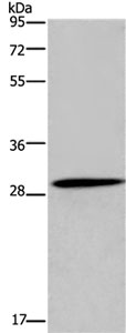 Western blot - Anti-GLIPR1 antibody (AB198215)