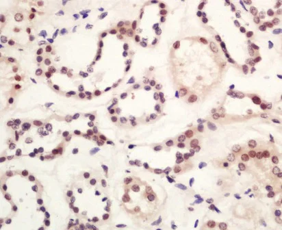Immunohistochemistry (Formalin/PFA-fixed paraffin-embedded sections) - Anti-GLIS3 antibody (AB203121)