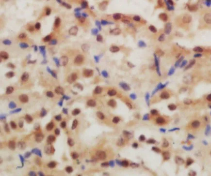 Immunohistochemistry (Formalin/PFA-fixed paraffin-embedded sections) - Anti-GLIS3 antibody (AB203121)