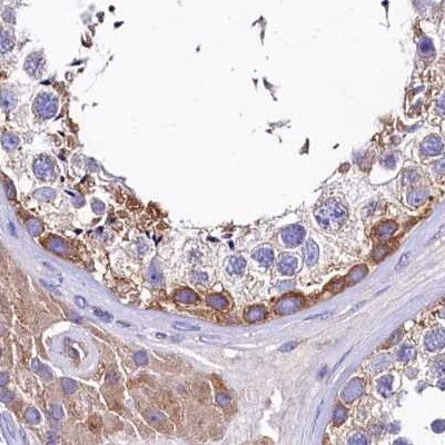 Immunohistochemistry (Formalin/PFA-fixed paraffin-embedded sections) - Anti-GlnRS antibody (AB252974)