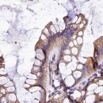 Immunohistochemistry (Formalin/PFA-fixed paraffin-embedded sections) - Anti-GlnRS antibody (AB252974)