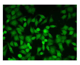 Immunocytochemistry/ Immunofluorescence - Anti-GLO1 antibody [6F10] (AB81461)
