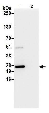 Immunoprecipitation - Anti-GLO1 antibody (AB264389)
