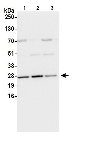 Western blot - Anti-GLO1 antibody (AB264389)