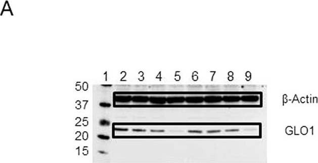 Anti-GLO1 antibody