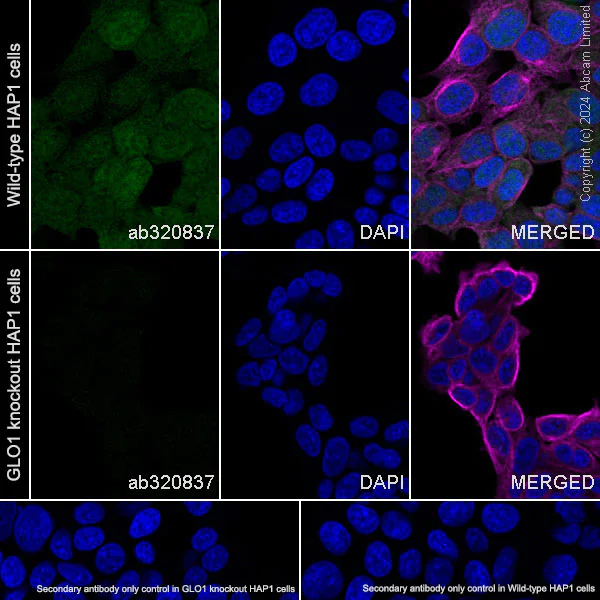 Immunocytochemistry/ Immunofluorescence - Anti-GLO1 antibody [EPR29834-525] (AB320837)