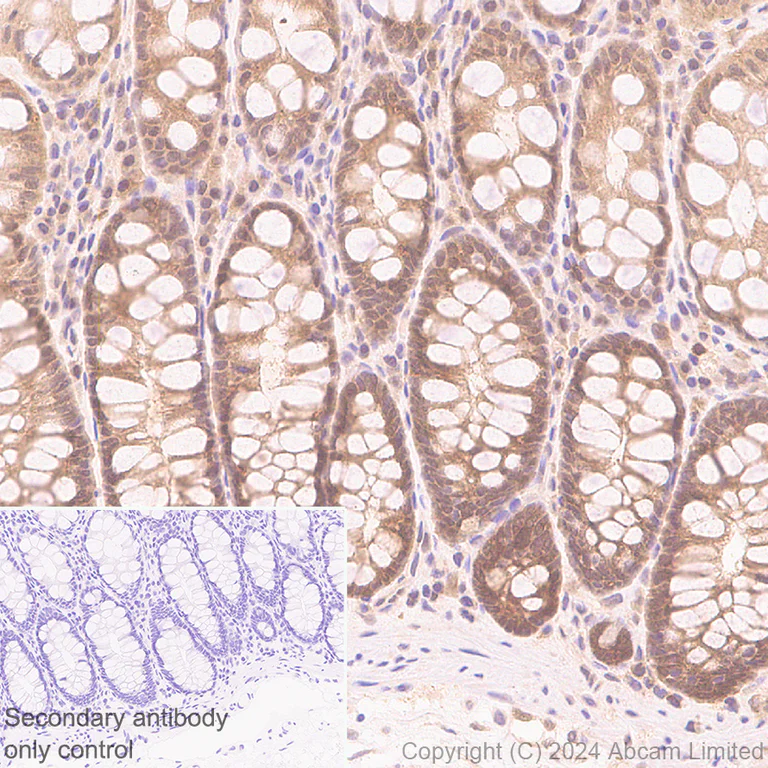 Immunohistochemistry (Formalin/PFA-fixed paraffin-embedded sections) - Anti-GLO1 antibody [EPR29834-525] (AB320837)