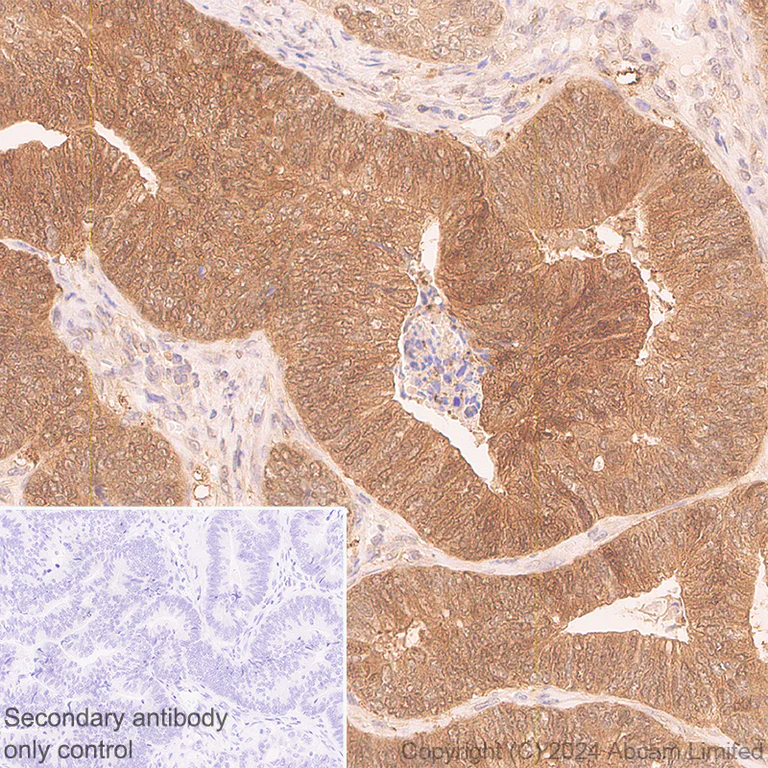 Immunohistochemistry (Formalin/PFA-fixed paraffin-embedded sections) - Anti-GLO1 antibody [EPR29834-525] (AB320837)