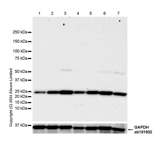 Western blot - Anti-GLO1 antibody [EPR29834-525] (AB320837)