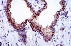 Immunohistochemistry (Formalin/PFA-fixed paraffin-embedded sections) - Anti-GLO1 antibody [Glo1a] (AB171121)