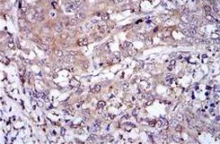 Immunohistochemistry (Formalin/PFA-fixed paraffin-embedded sections) - Anti-GLO1 antibody [Glo1a] (AB171121)