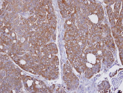 Immunohistochemistry (Formalin/PFA-fixed paraffin-embedded sections) - Anti-GLO2 antibody (AB154108)