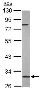 Western blot - Anti-GLO2 antibody (AB154108)