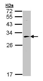 Western blot - Anti-GLO2 antibody (AB154108)