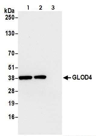 Immunoprecipitation - Anti-GLOD4 antibody (AB242089), expandable thumbnail