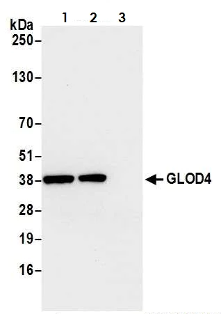 Immunoprecipitation - Anti-GLOD4 antibody (AB242089)