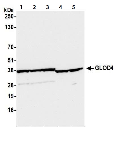 Western blot - Anti-GLOD4 antibody (AB242089), expandable thumbnail