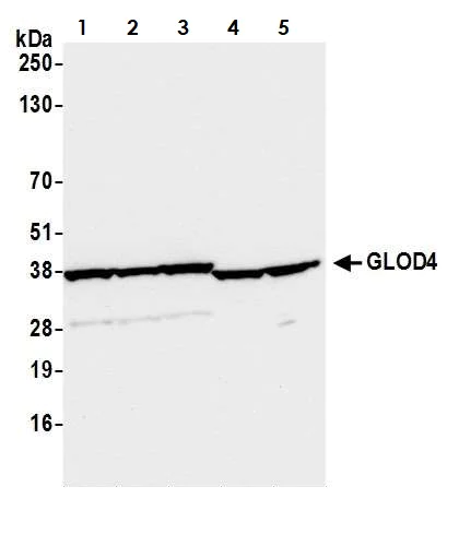 Western blot - Anti-GLOD4 antibody (AB242089)