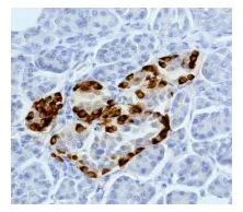 Immunohistochemistry (Formalin/PFA-fixed paraffin-embedded sections) - Anti-GLP-1 antibody [EPR4042-1] - BSA and Azide free (AB226036)