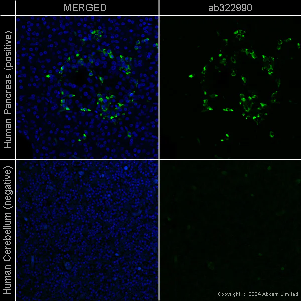 Immunohistochemistry (Formalin/PFA-fixed paraffin-embedded sections) - Anti-GLP-1 antibody [EPR4042-1] - Mouse IgG1 (Chimeric) (AB322990)
