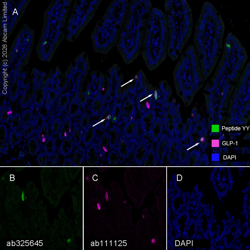 anti glp 1 Anti-GLP-1 antibody [EPR4042-407] (ab111125)
